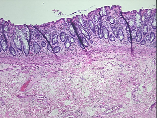 4x Image