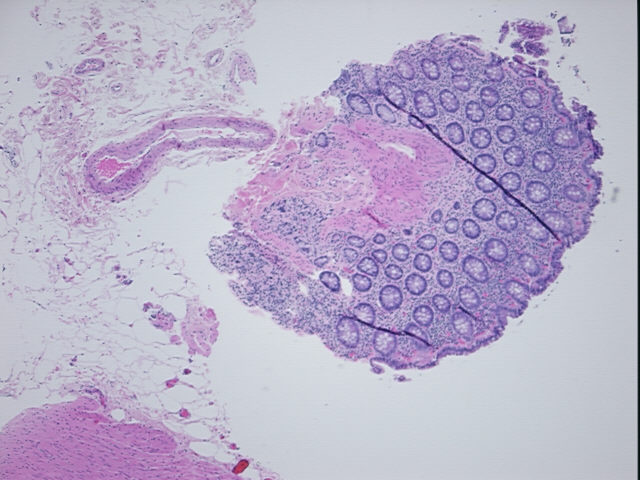 4x Image