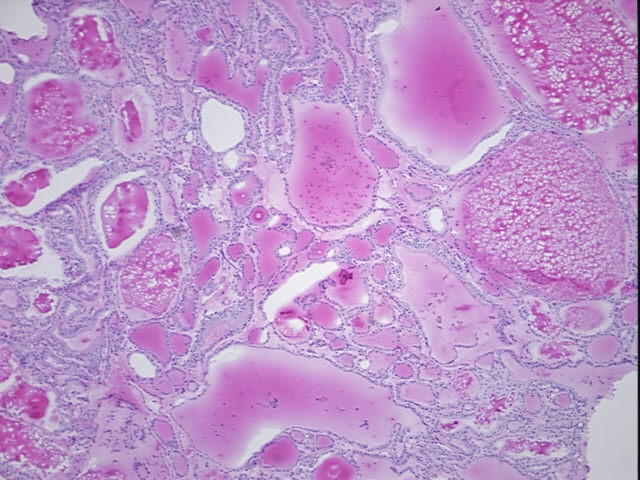 4x Image