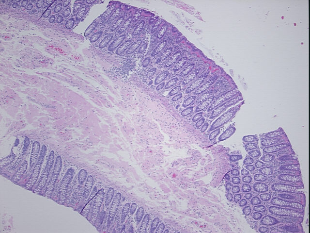 4x Image
