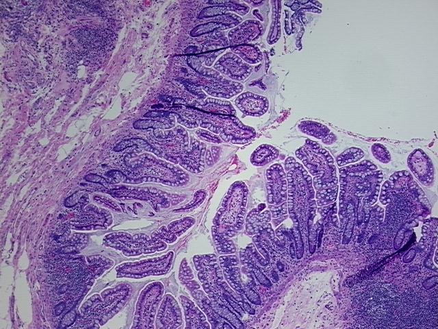 4x Image