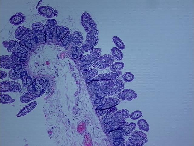 4x Image