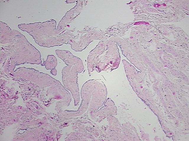 4x Image