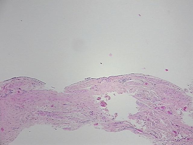 4x Image