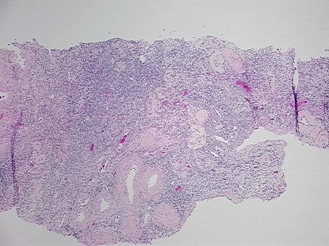 4x Image
