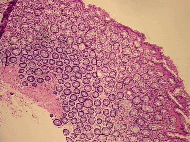 4x Image