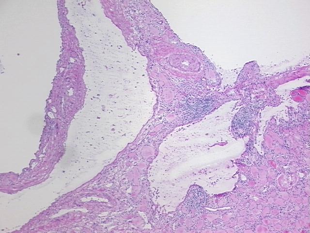 4x Image