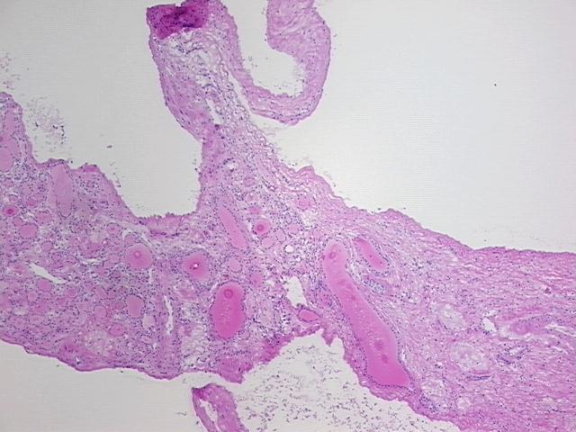 4x Image