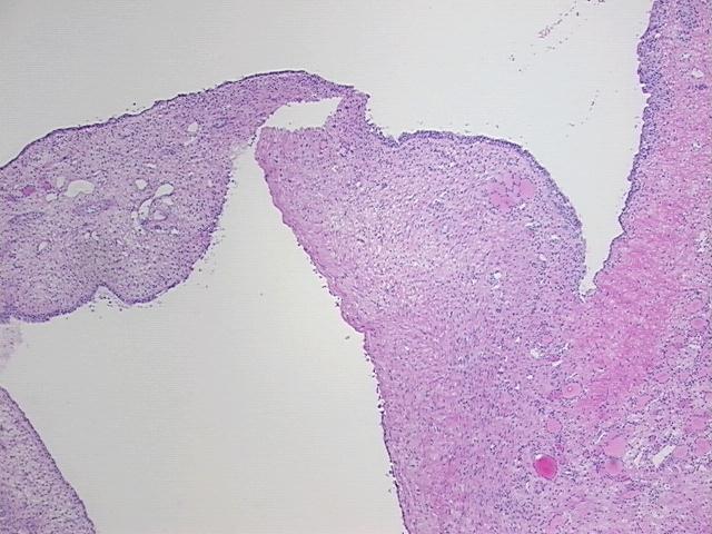 4x Image
