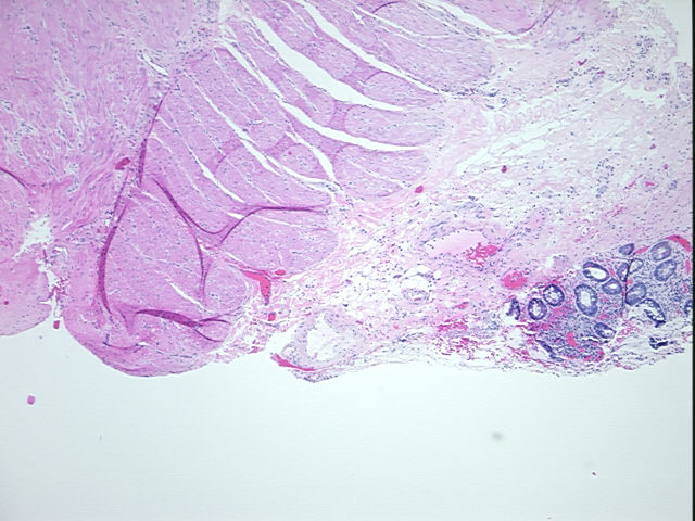 4x Image