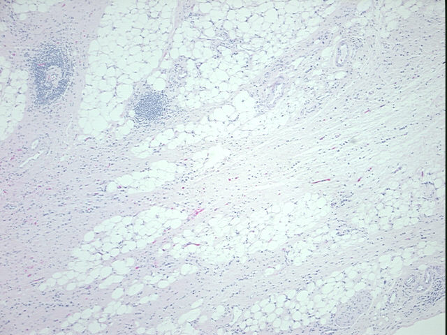 4x Image