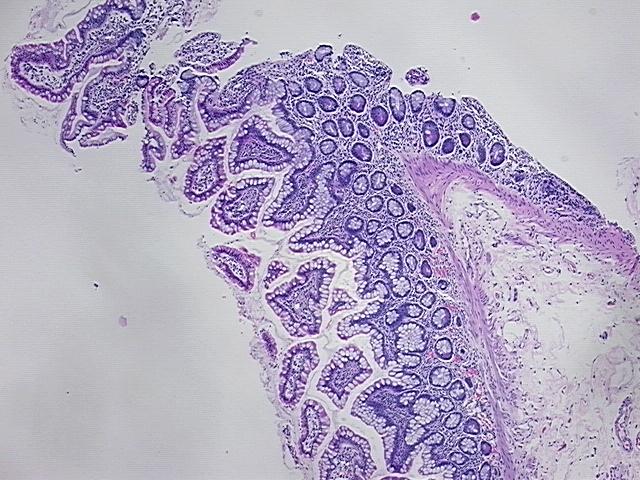 4x Image