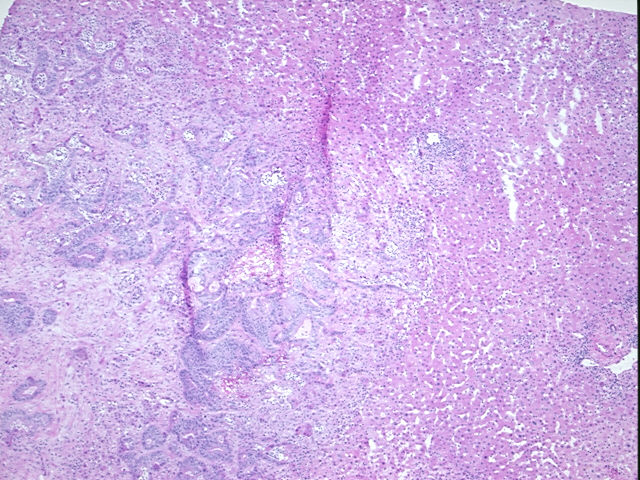 4x Image