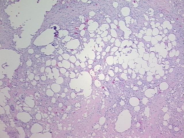 4x Image