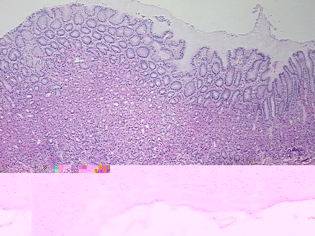 4x Image