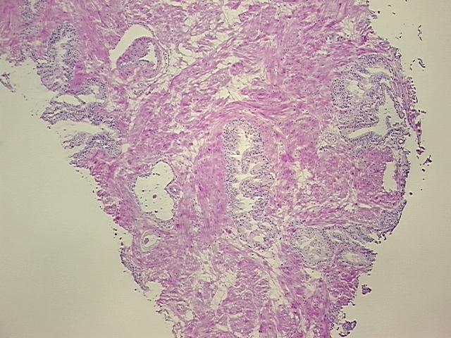 4x Image