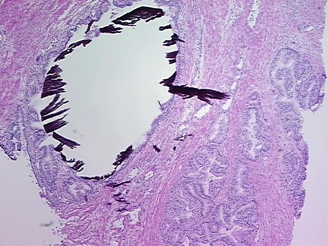 4x Image