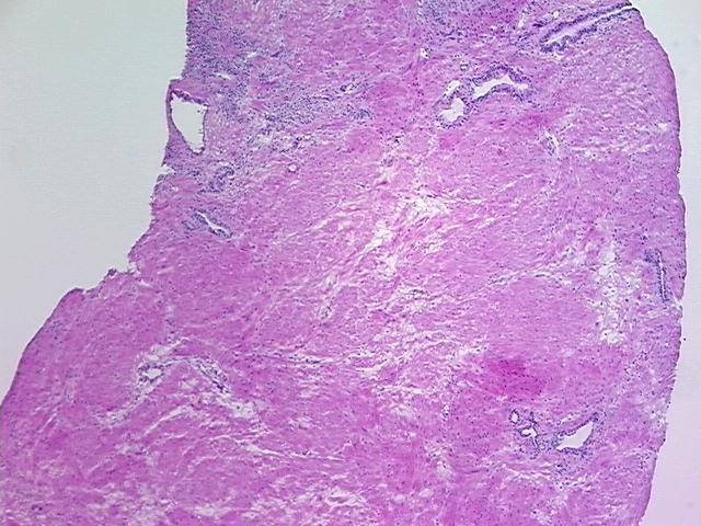 4x Image
