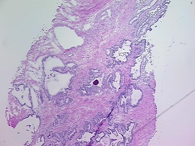 4x Image
