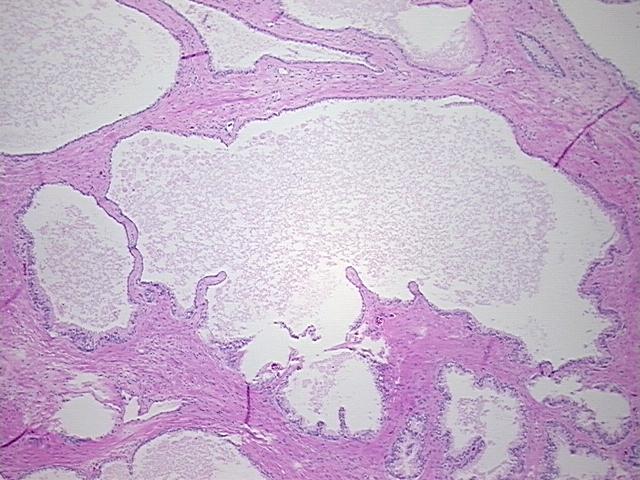 4x Image