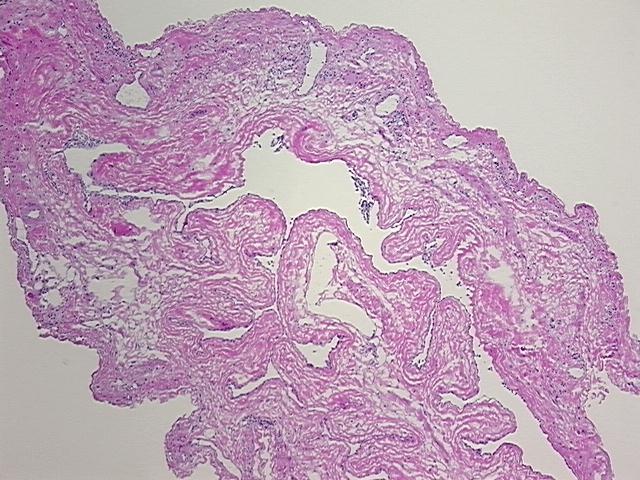4x Image