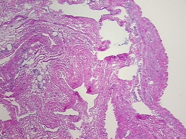 4x Image