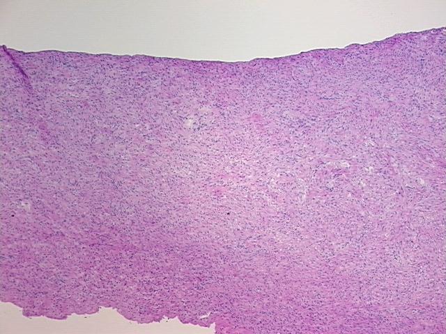 4x Image