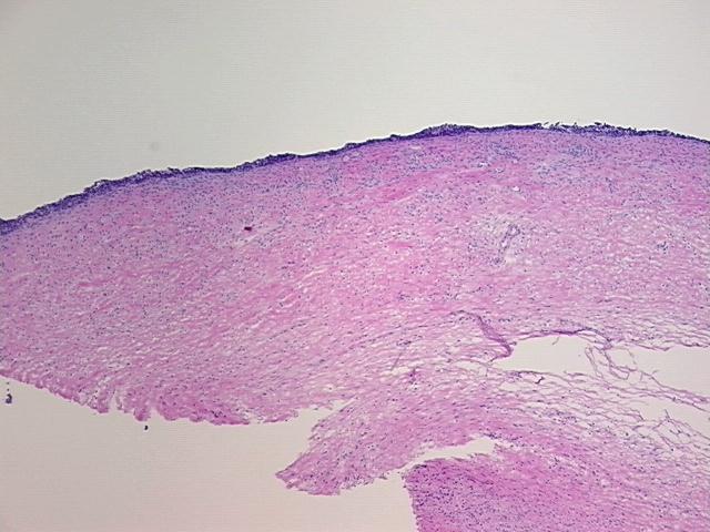 4x Image