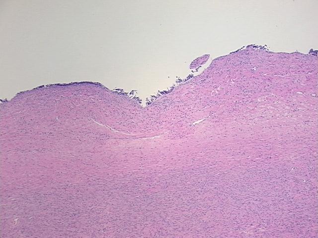 4x Image