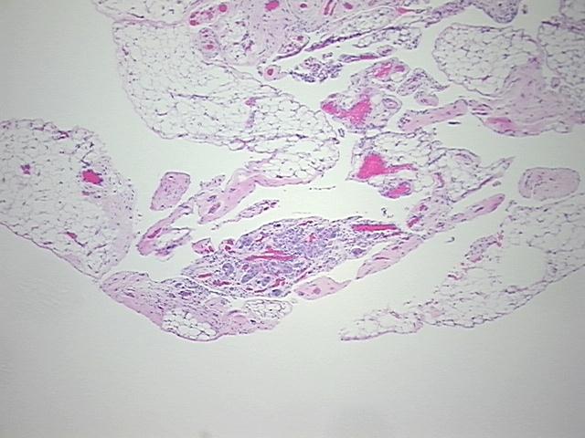 4x Image