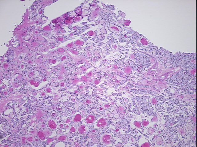 4x Image