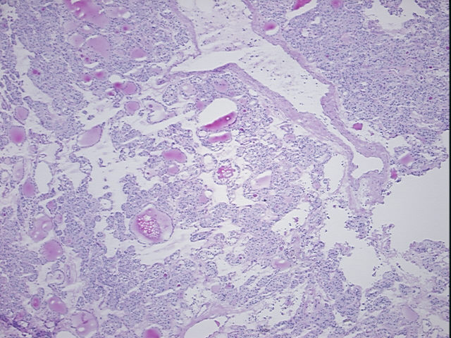 4x Image
