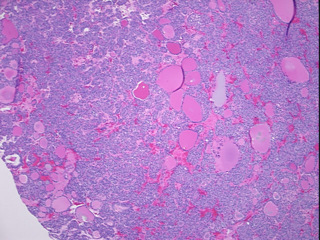 4x Image