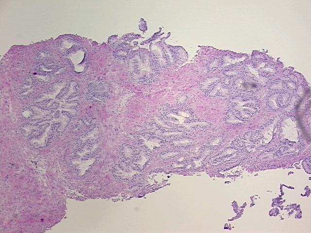4x Image