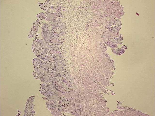 4x Image