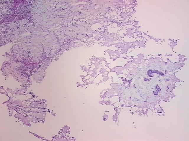 4x Image