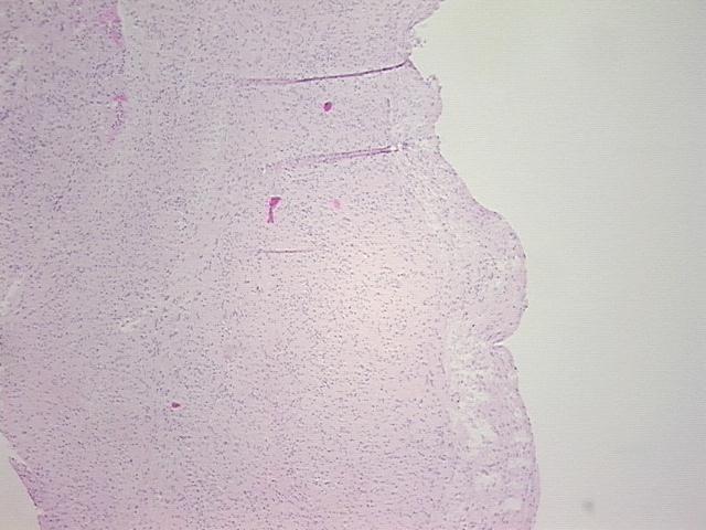 4x Image