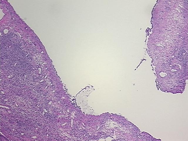 4x Image