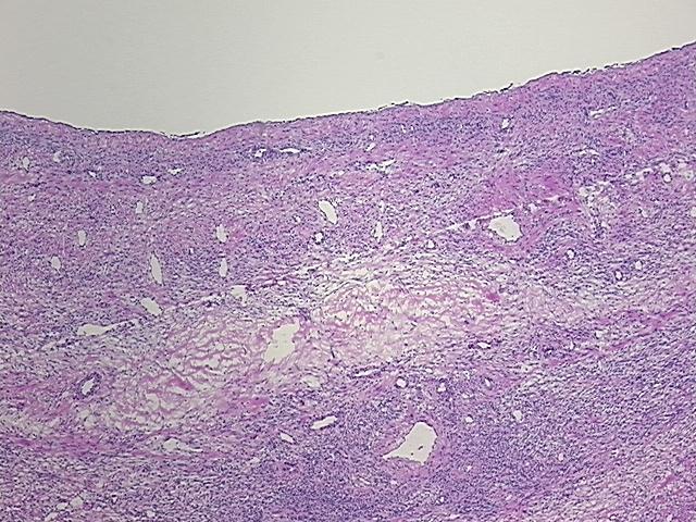 4x Image