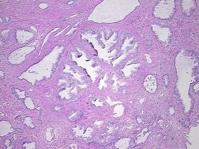 4x Image