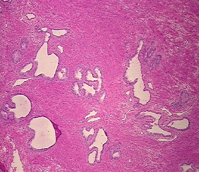 4x Image