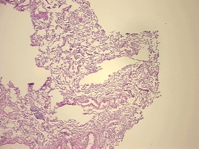 4x Image
