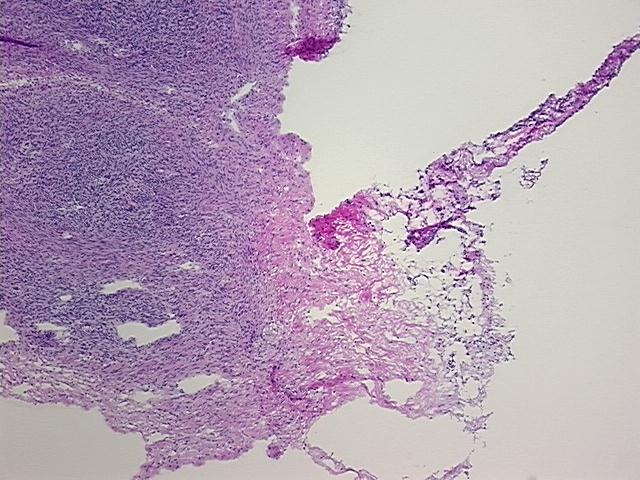 4x Image