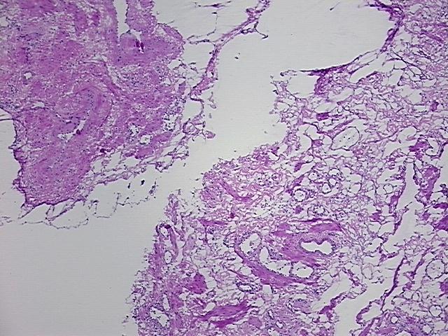 4x Image
