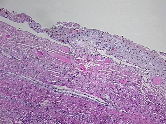 4x Image
