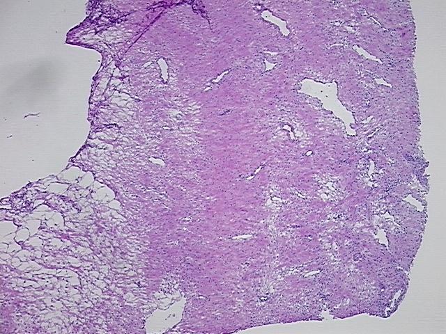 4x Image