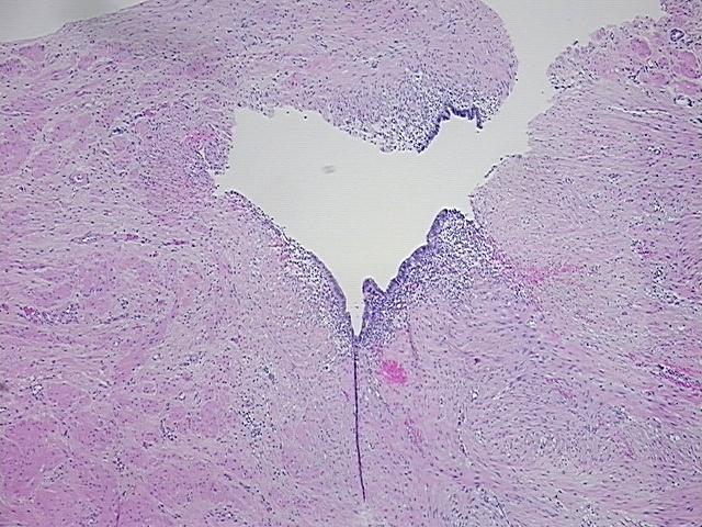 4x Image