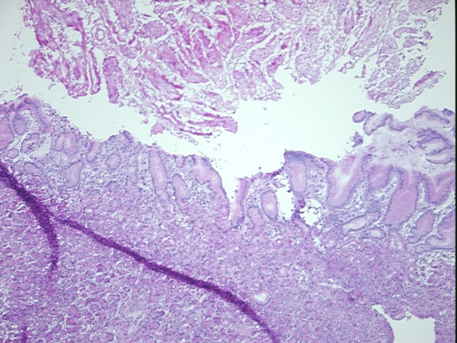 4x Image