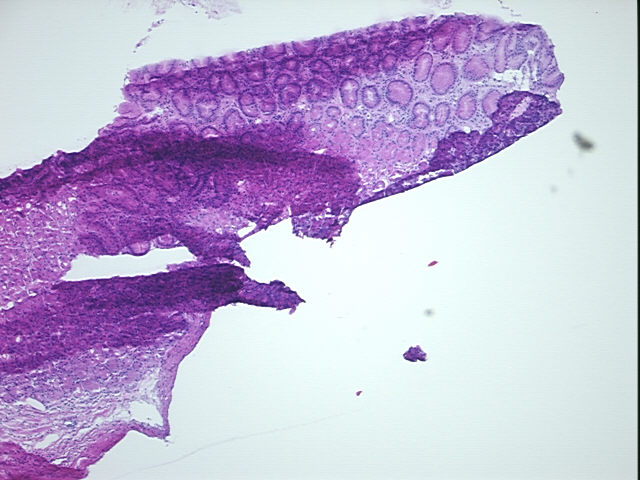 4x Image