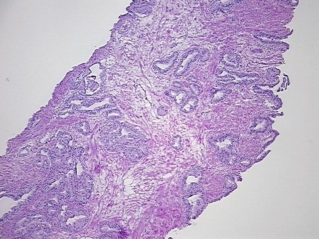 4x Image